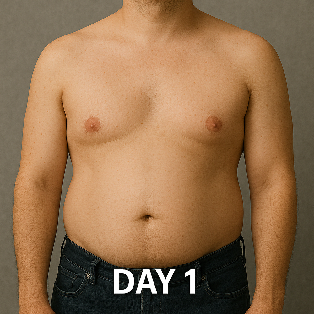 Before image